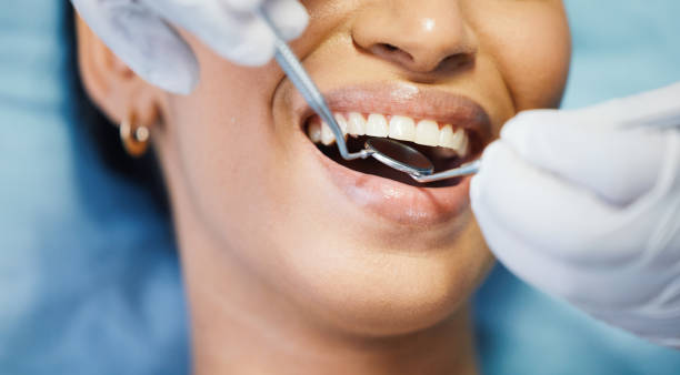 Best Emergency Dental Care for Abscessed Tooth in Green Springs, OH